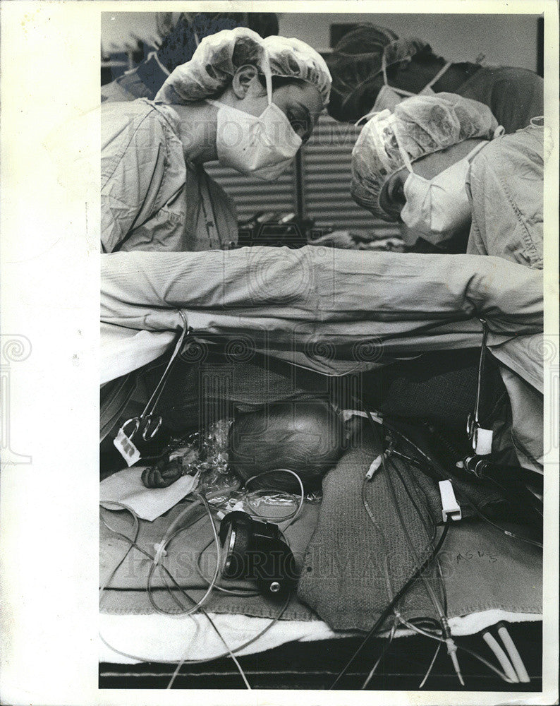 1982 Press Photo Dr. Susan Luck and Dr. Margaret Olson operate on 8 month old - Historic Images