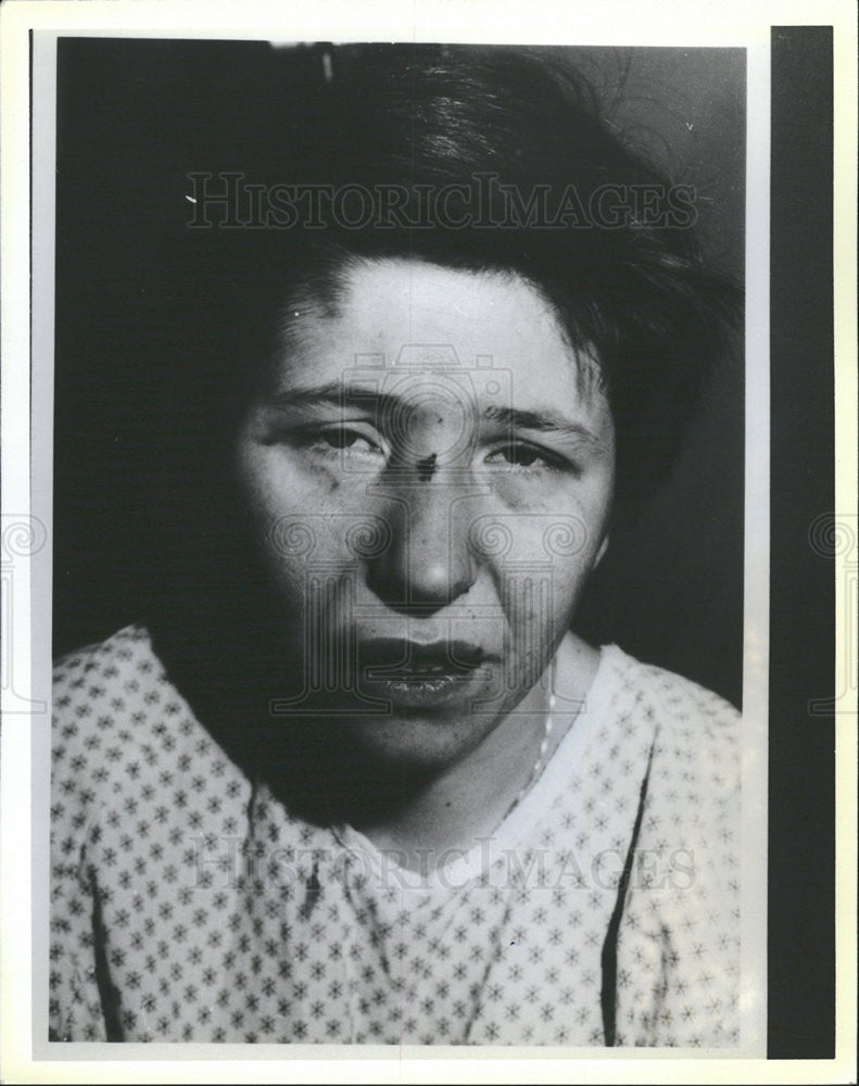 1986 Press Photo Austin District Officer Cathy Touhy after Beating - Historic Images