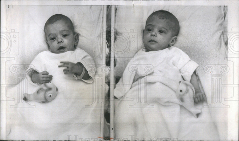 1953 Press Photo Conjoined Twins Catherine Anne &amp; Carolyn Anne Mouton Seperated - Historic Images