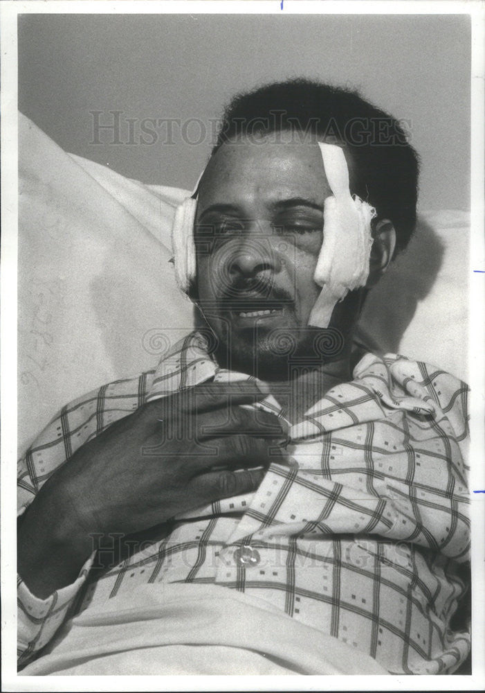 1977 Press Photo Jose Osario Wounded by Two Gunman He Was Left Blind - Historic Images