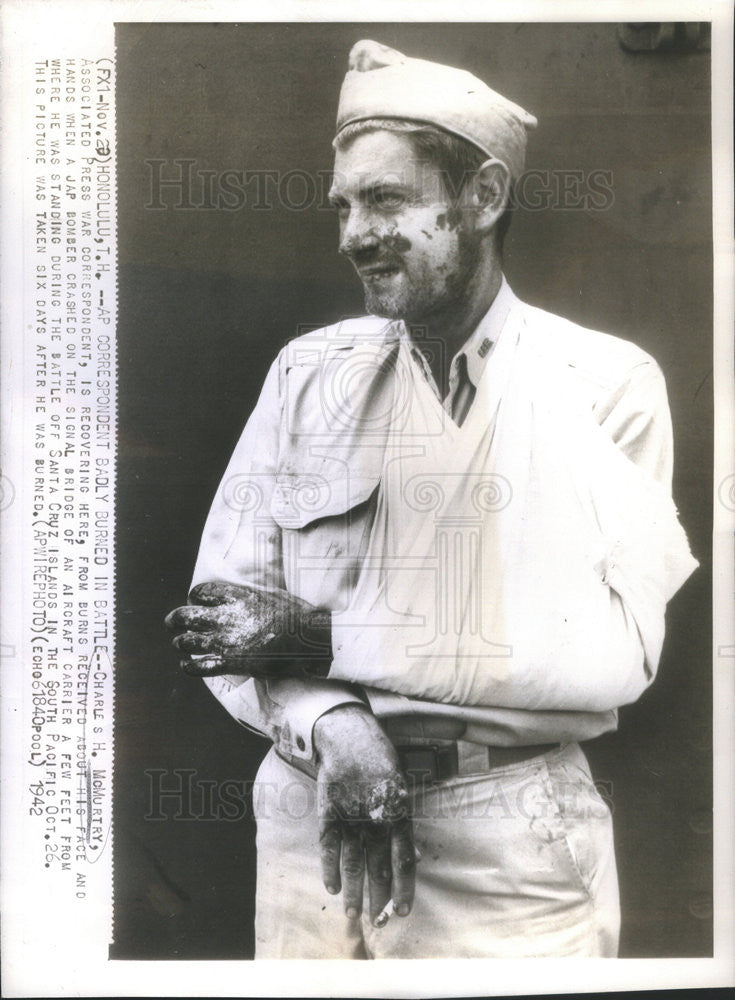 1942 Press Photo Associated Press War Correspondent Charles H. McMurtry Burned - Historic Images