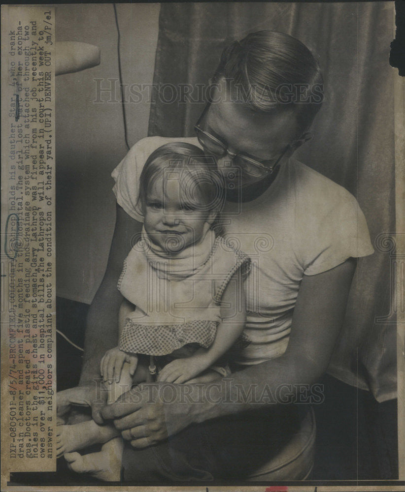 1974 Press Photo Gary Lathrop and daughter Star who drank drain cleaner - Historic Images