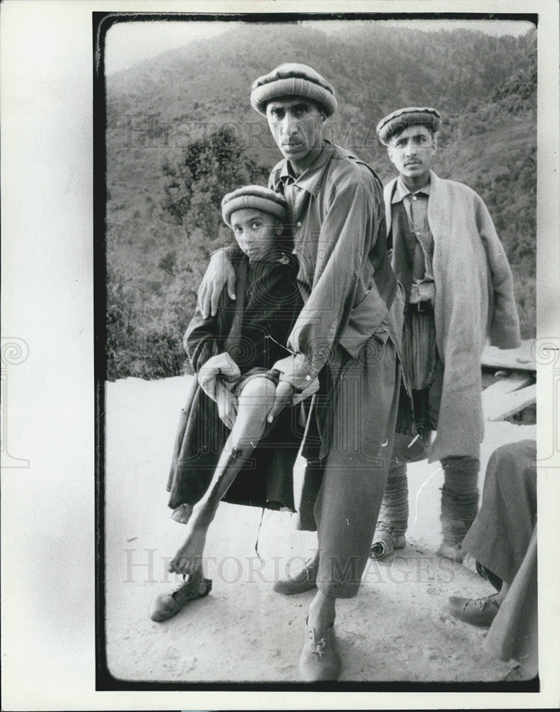 1982 Press Photo Boy injured by Russian butterfly anti personnel bomb. - Historic Images