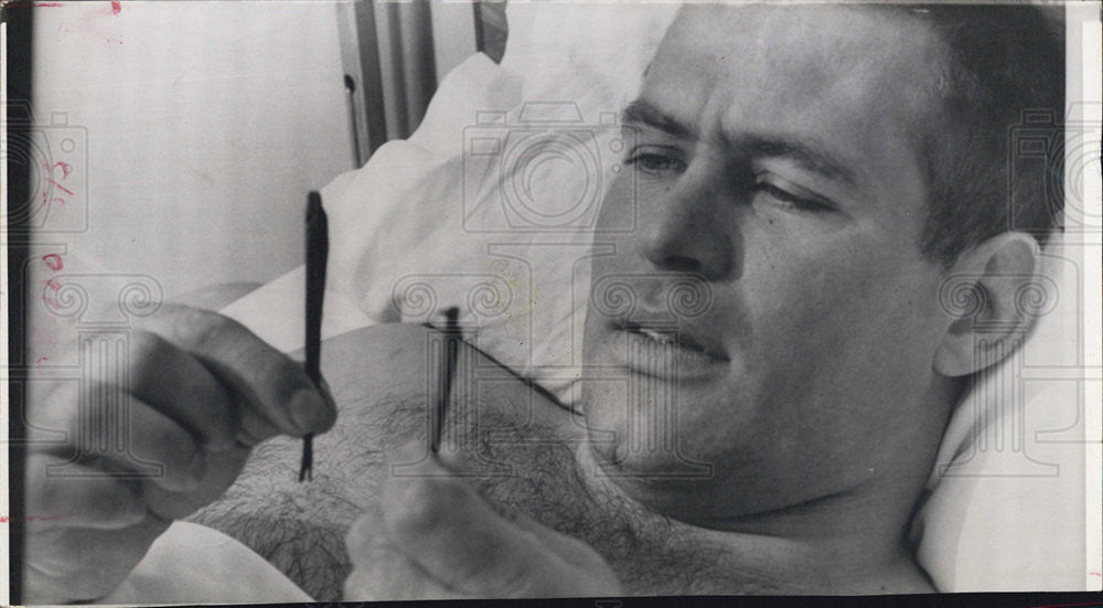 1968 Press Photo Jerry Kramer shows three piece of wood removed from Operations - Historic Images