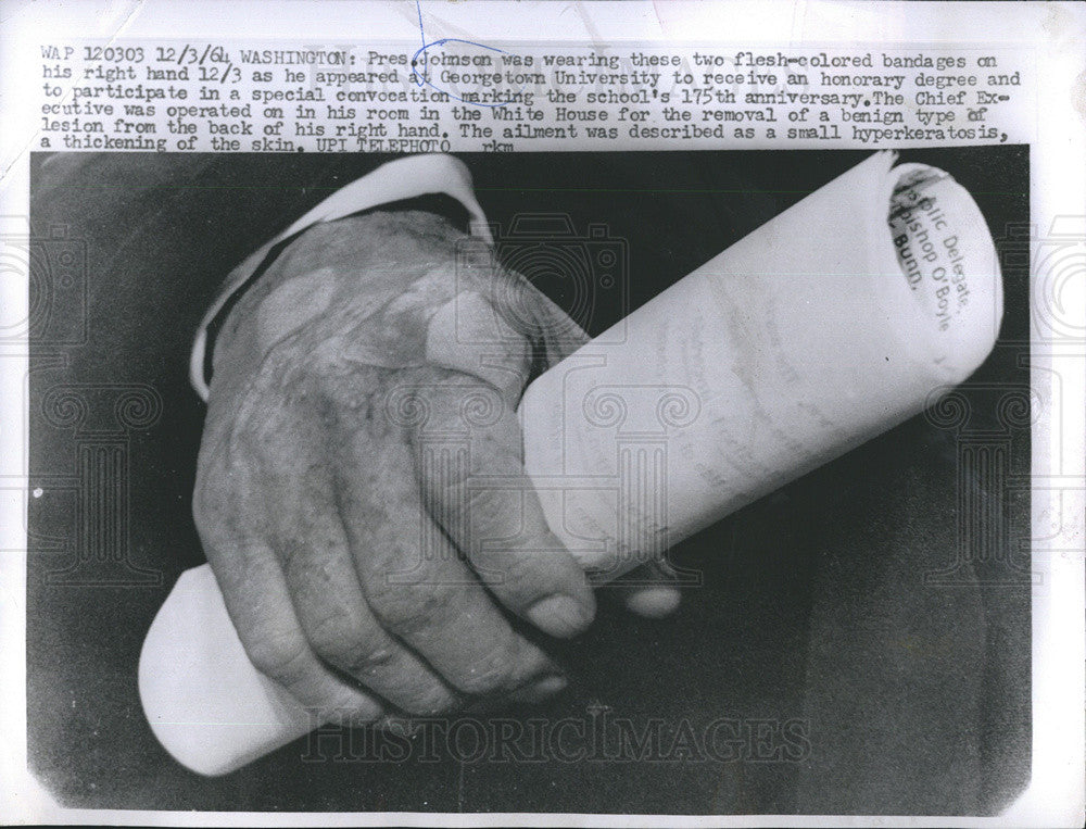 1964 Press Photo Pres.Johnson hands with bandages. - Historic Images