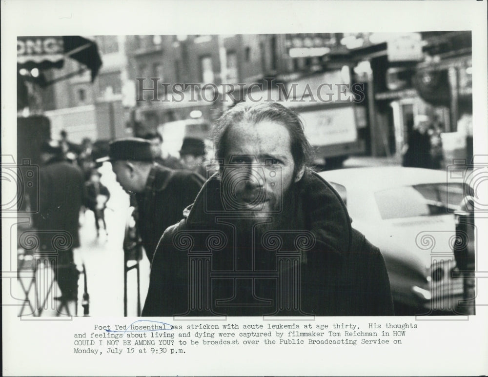 1974 Press Photo Poet Ted Rosenthal Diagnosed with Acute Leukemia - Historic Images