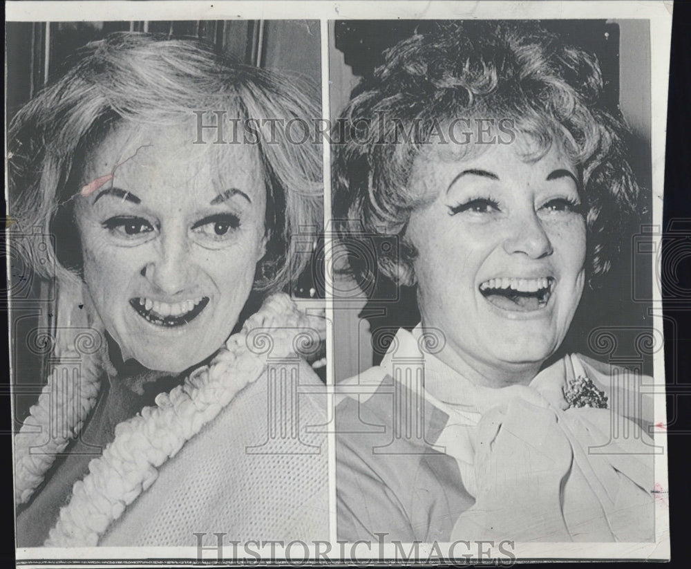 1972 Actress Phyllis Diller Before And After Plastic Surgery - Historic Images