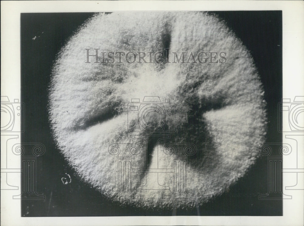 1943 Penicillium Notatum Enlarged Mold That Makes Up Penicillin - Historic Images