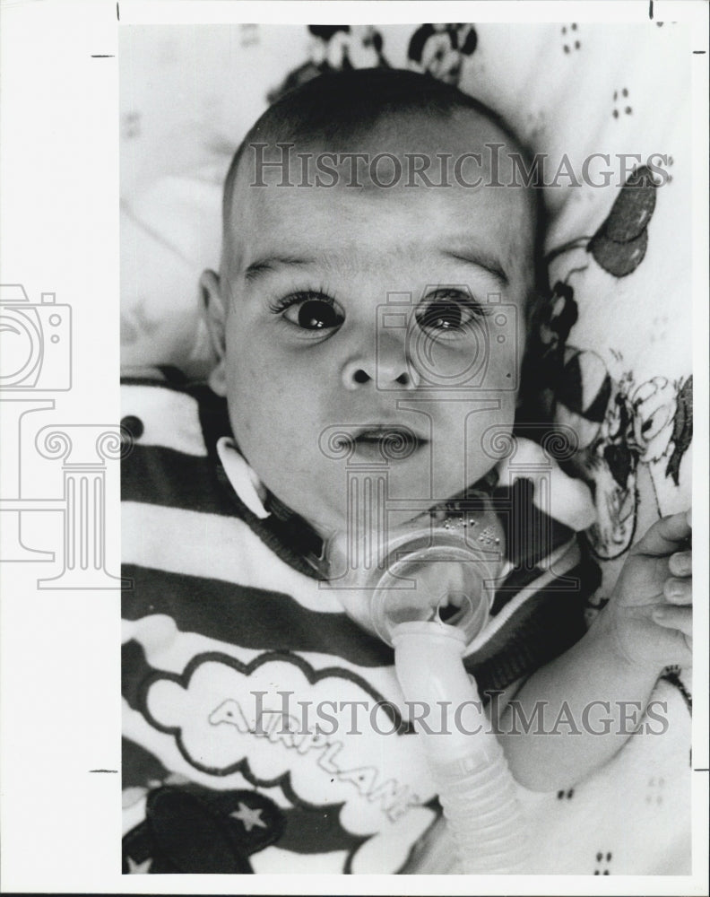 1989 Press Photo Payton Christopher Gadd Premature Baby Breathing Difficulties - Historic Images