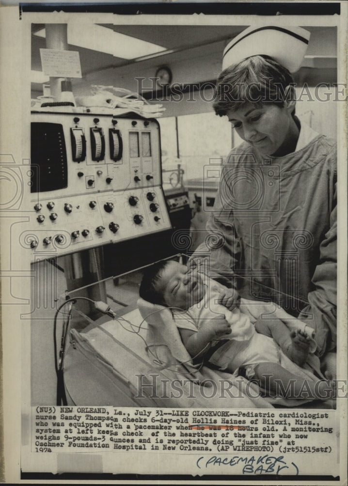 1974  Sandy Thompson holds the baby with peacemaker. - Historic Images