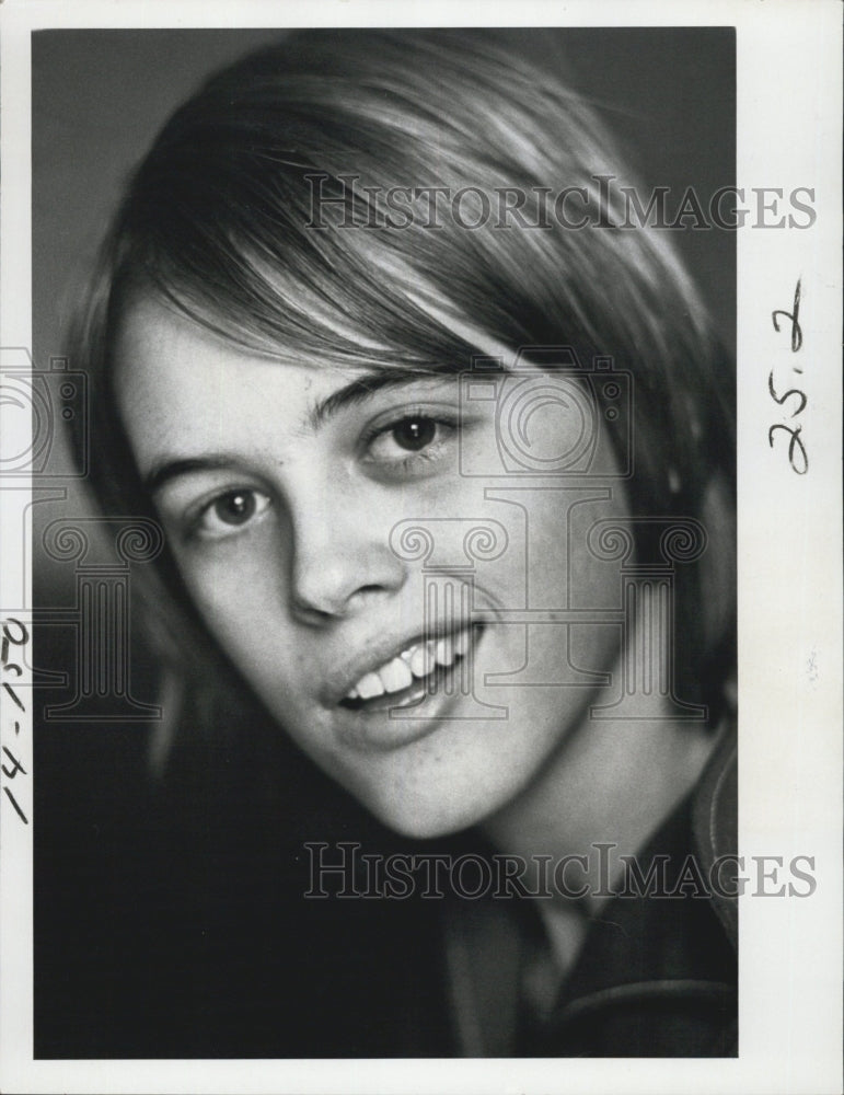 1977 Press Photo Janet Hannon After Motorcycle Accident - RSG64905 - Historic Images