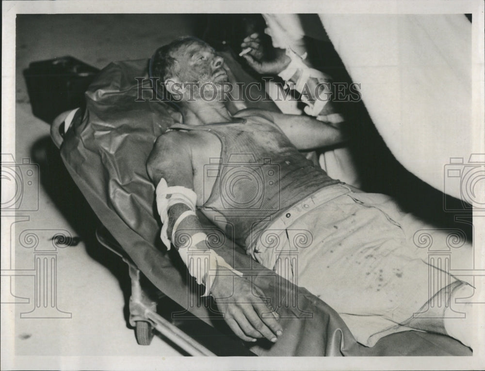 Press Photo Man Rescued By Coast Guard Disheveled And Dirty Smoking On Gurney - Historic Images