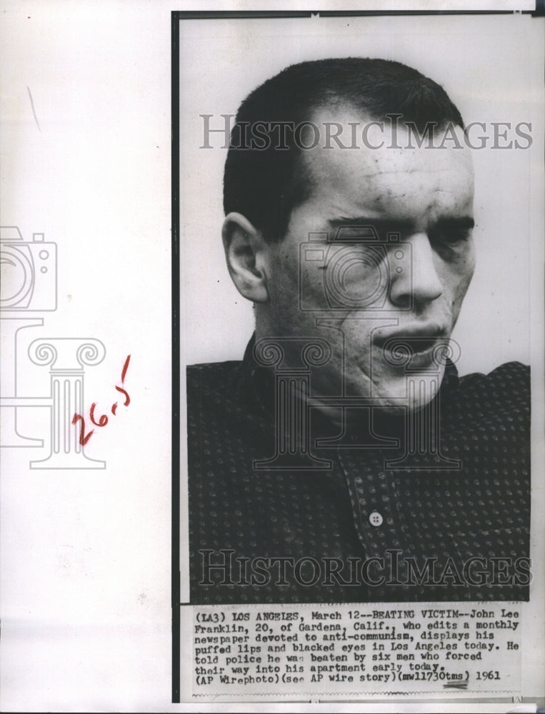 1961 John Lee Franklin After Beating in Apartment  - Historic Images