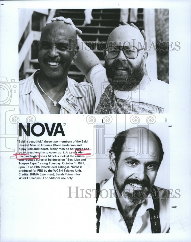 1991 Press Photo Don Henderson Kippy Kirkland Alan Rachins Baldness Science NOVA - Historic Images