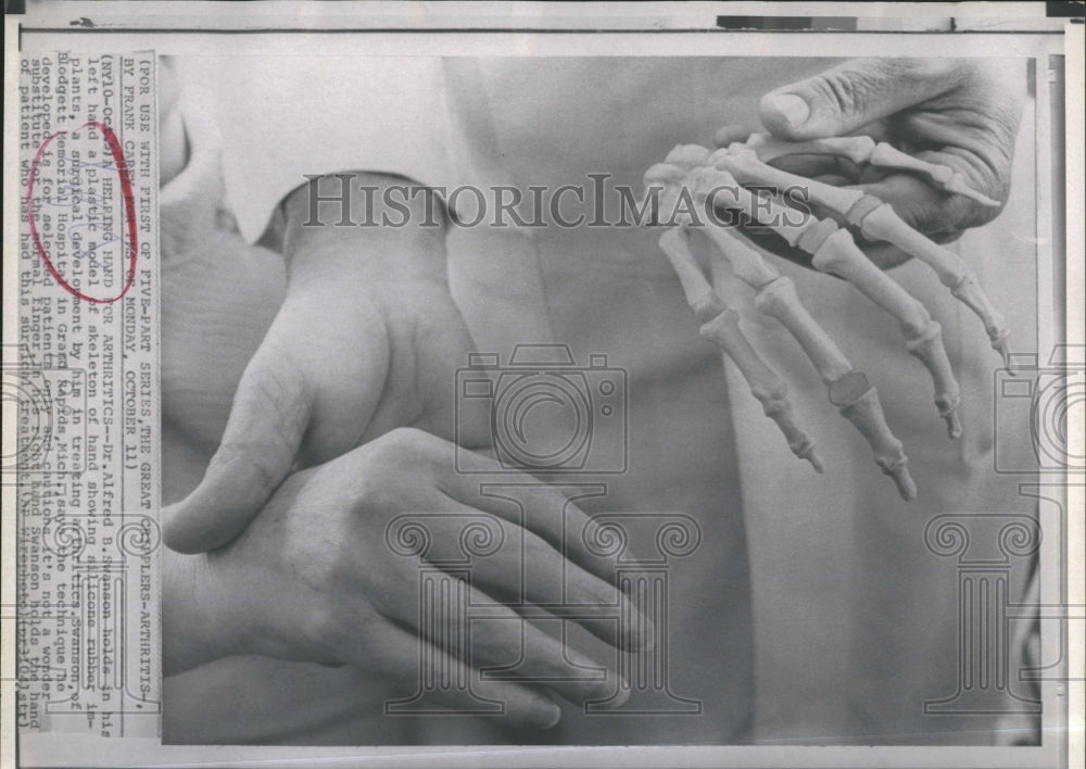 Press Photo Dr Alfred B Swanson holding 2 hand models - Historic Images