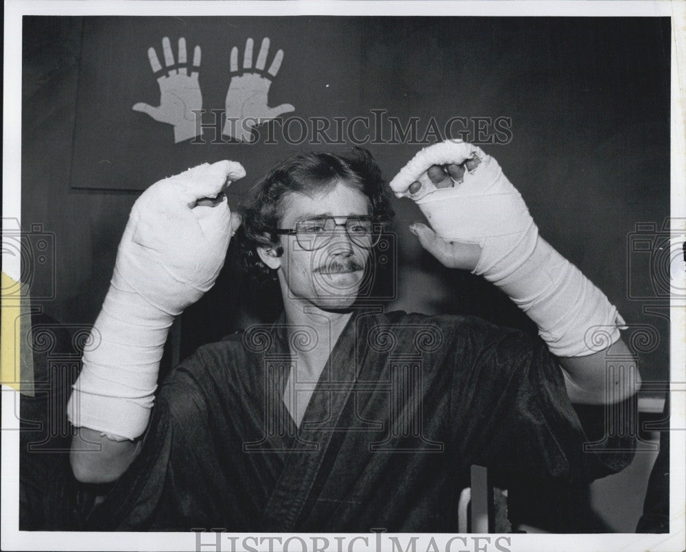 Press Photo Michael Bates Shows Off Record Number Of Reattached Fingers - Historic Images