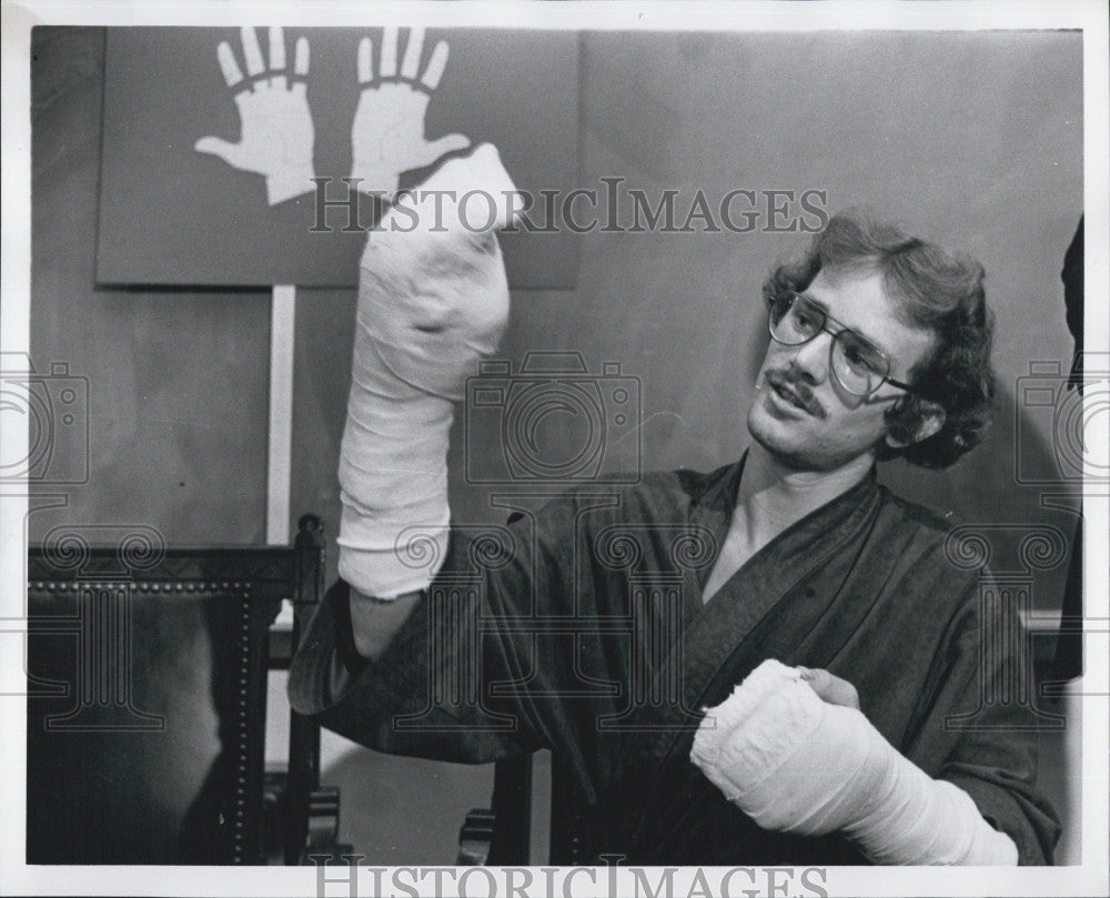 1981 Press Photo Michael Bates After Historic Surgery to Reattach Seven Fingers - Historic Images