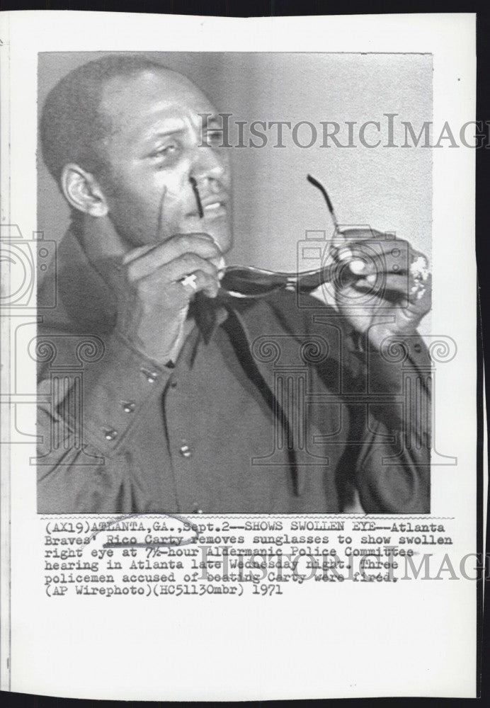 1971 Press Photo Rico Carty Of Atlanta Braves Shows Swollen Eye - Historic Images