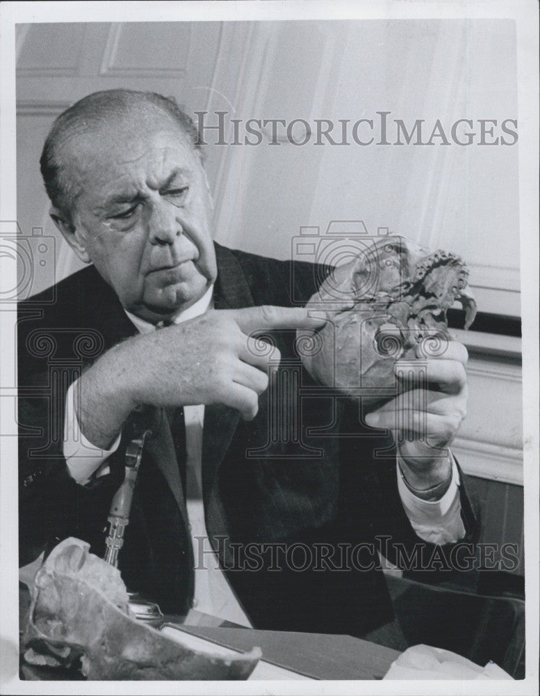 1968 Press Photo Dr. James L. Poppen with Skull - Historic Images