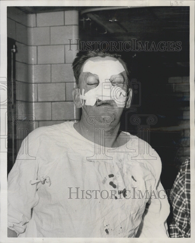 1960 Press Photo Eugene Corbett, Police Officer Attacked in Park - Historic Images