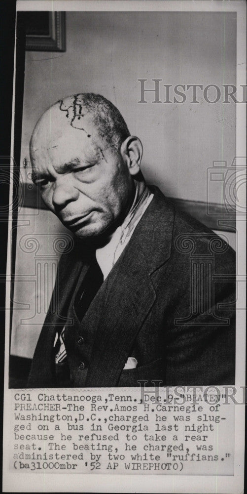 1952 Press Photo Rev Amos Carnegis of Washington DC Beaten by 2 White Males - Historic Images