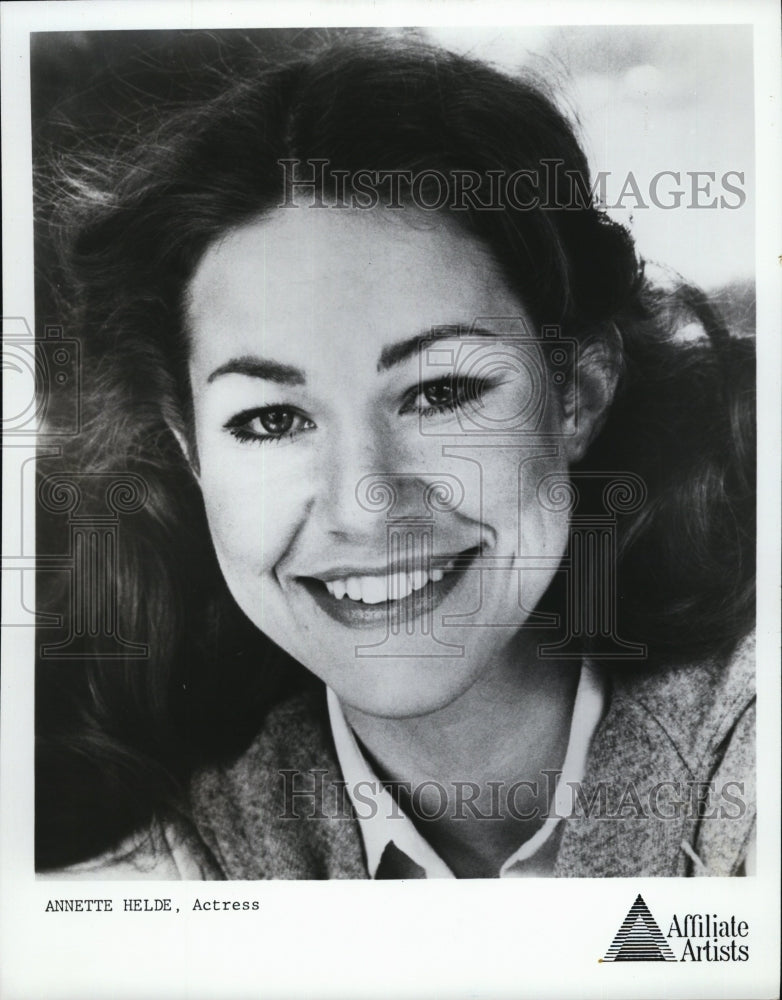 1985 Press Photo Actress Annette Helde - RSM05371 - Historic Images