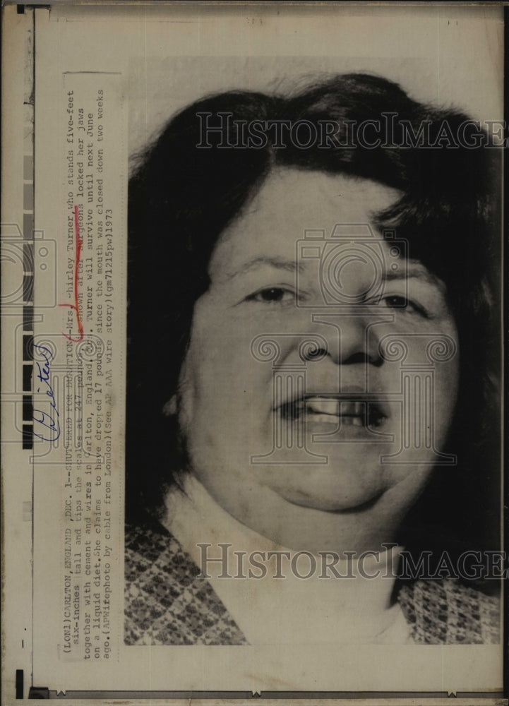 1973 Press Photo Shirley Turner, jaw wired shut for a diet in England - Historic Images