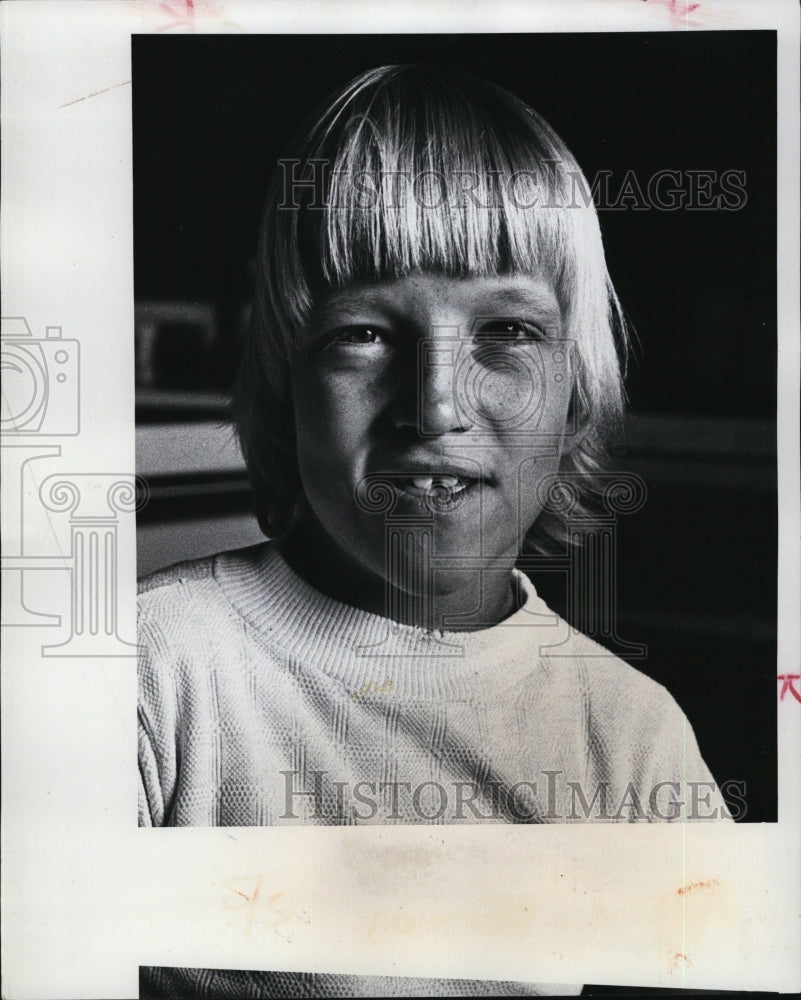 1976 Press Photo Mark Werblow prior to operation deaf child - RSM06983 - Historic Images