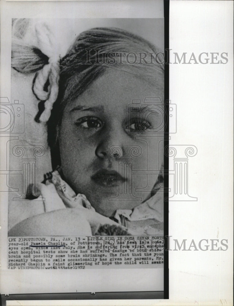 1972 Press Photo Pamela Chaplin in coma with eyes open seven month old - Historic Images