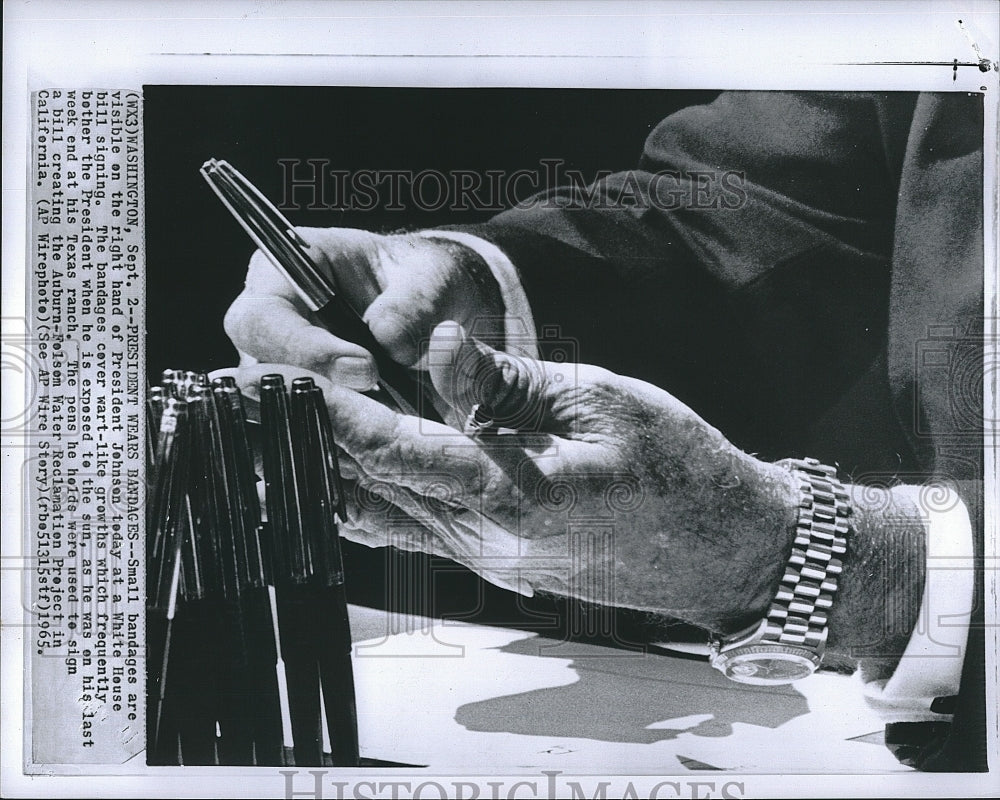 1965 Press Photo President Johnson with bandages on hands - Historic Images