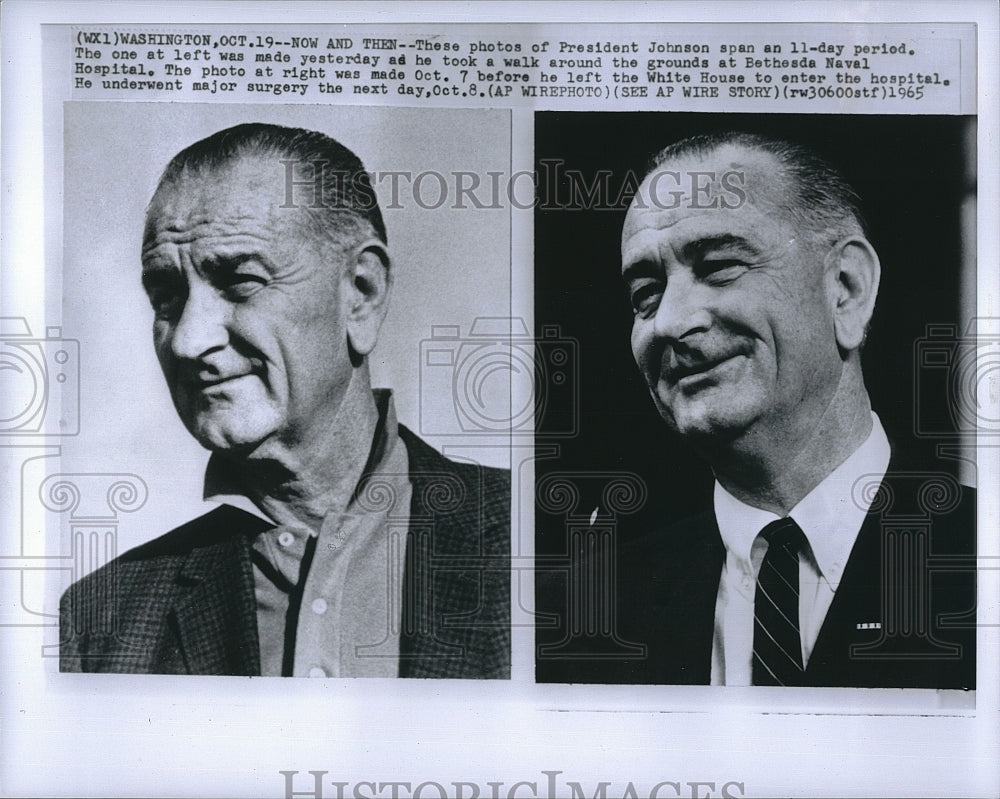 1965 Press Photo US President Lyndon B. Johnson, Surgery, Bethesda Navy Hospital - Historic Images