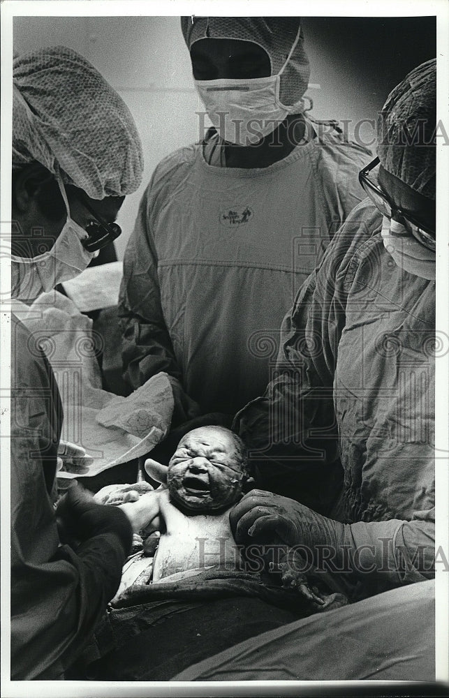 1980 Press Photo Caesarean Section Birth procedure. - Historic Images