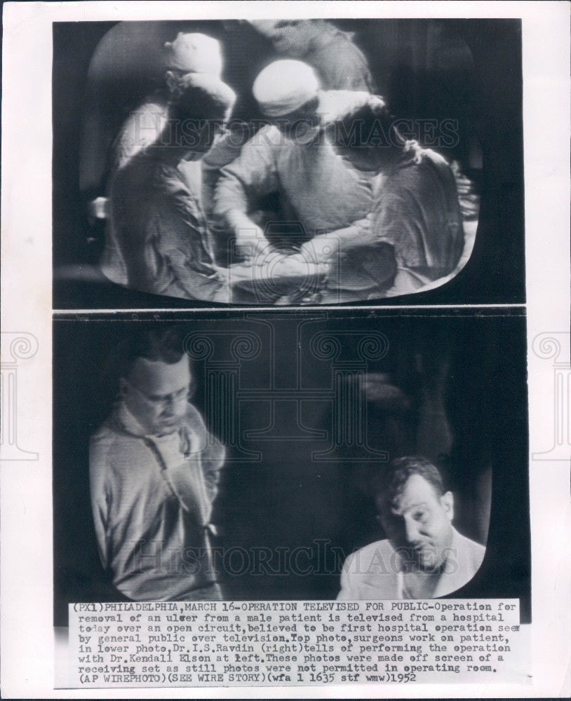 1952 TV Broadcast Hospital Operation Press Photo - Historic Images