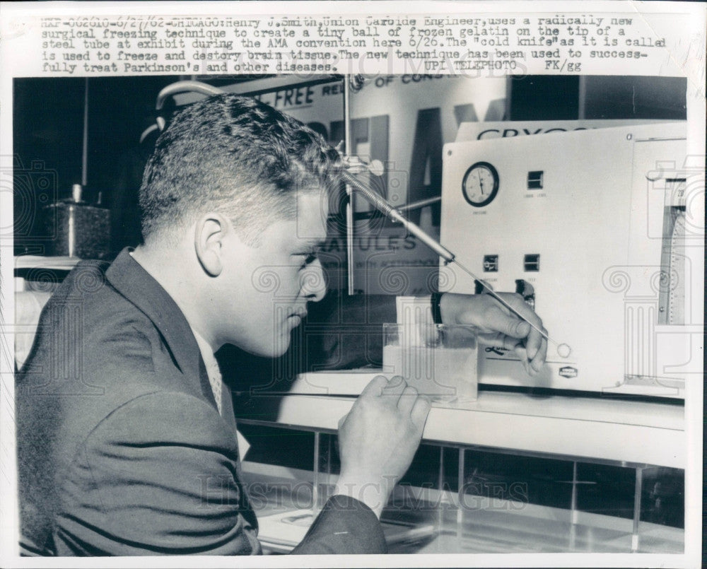 1962 Surgical Freezing Technique Press Photo - Historic Images