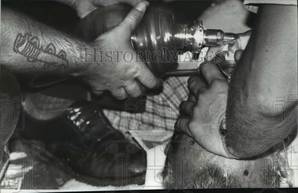 1981 Press Photo Alabama-Medics try to resuscitate a victim of an accident. - Historic Images