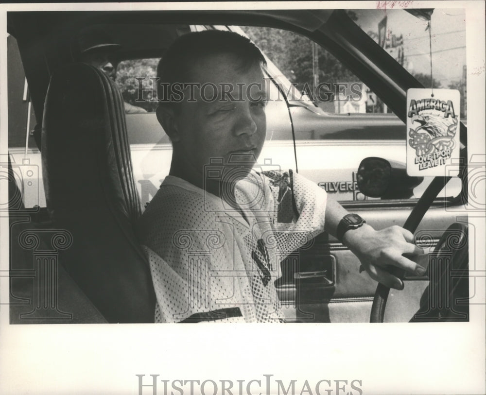 1992 Press Photo Michael Abbott has elephant man&#39;s disease, Birmingham, Alabama - Historic Images