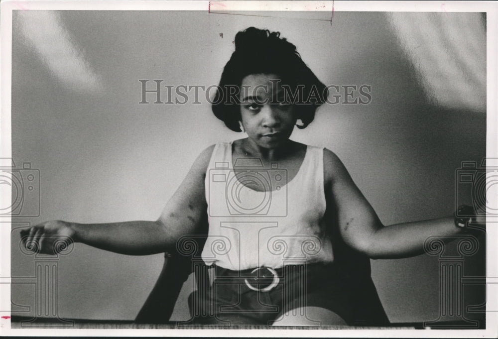 1990, Erica Lynn Arrington, copy of photo showing her marks, Alabama - Historic Images