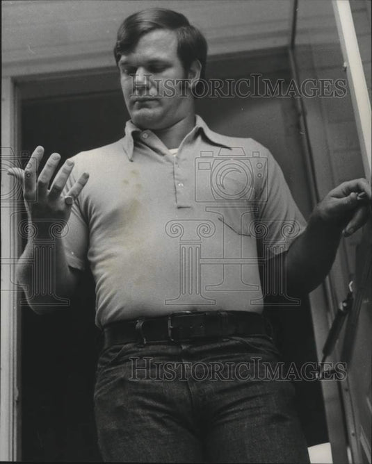 1975, Birmingham Officer Cliff Prosser after hit by lightning - Historic Images