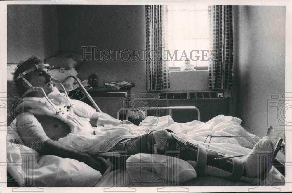 1987, Ken Shrader, burn victim, in hospital at University of Alabama - Historic Images