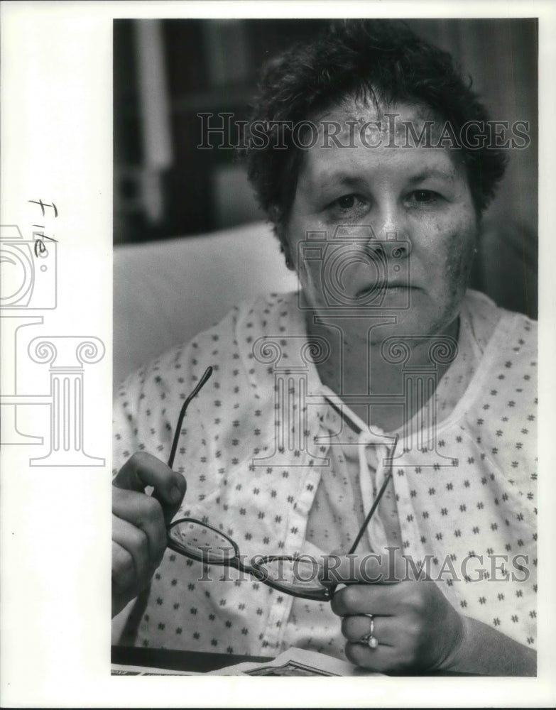 1990 Media Photo Heidi Austin recovers from having oven cleaner thrown in face - Historic Images