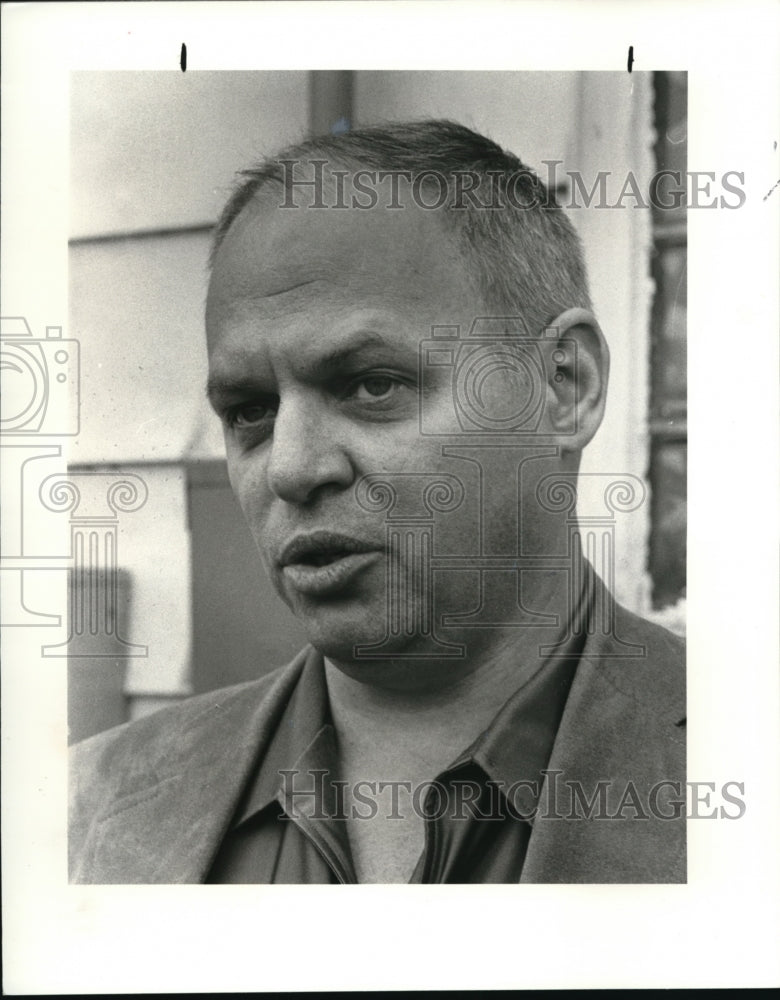 Hair Loss Dr Leonard's Sign In 1981 Press Photo Dr Leonard