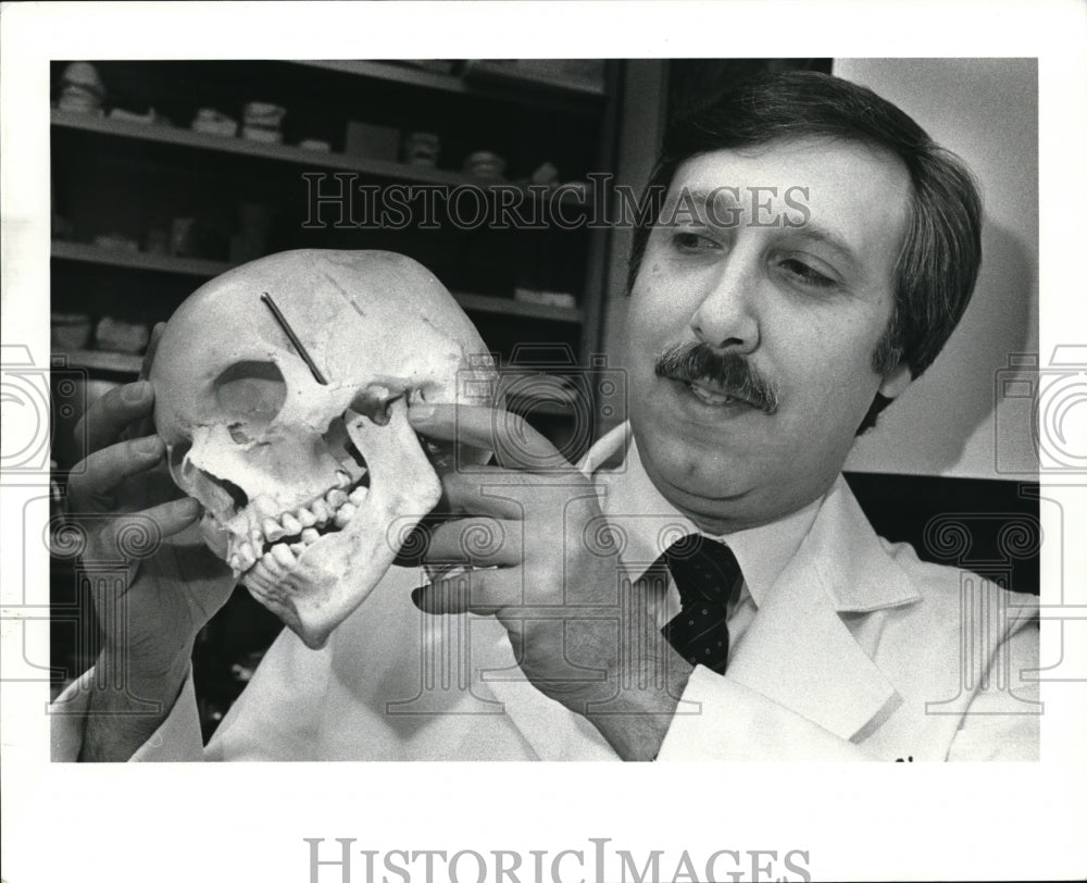 1983 Press Photo Dr. Jerold Goldberg holds a skeleton Head - Historic Images