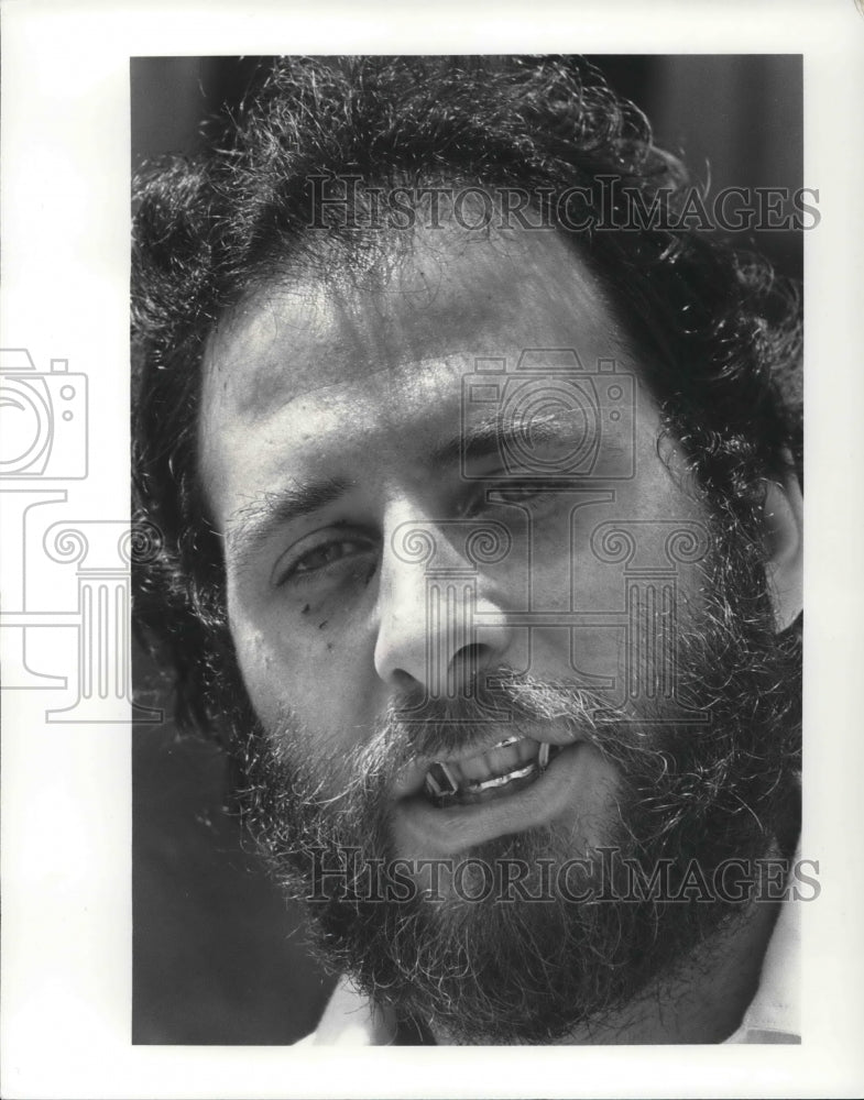 1981 Press Photo Jeremy Brustein with a jaw wired closed - Historic Images