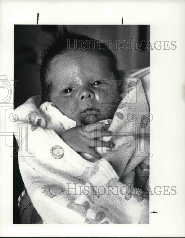 1987 Press Photo Andrew Render at Two Weeks Has Successful Surgery - Historic Images