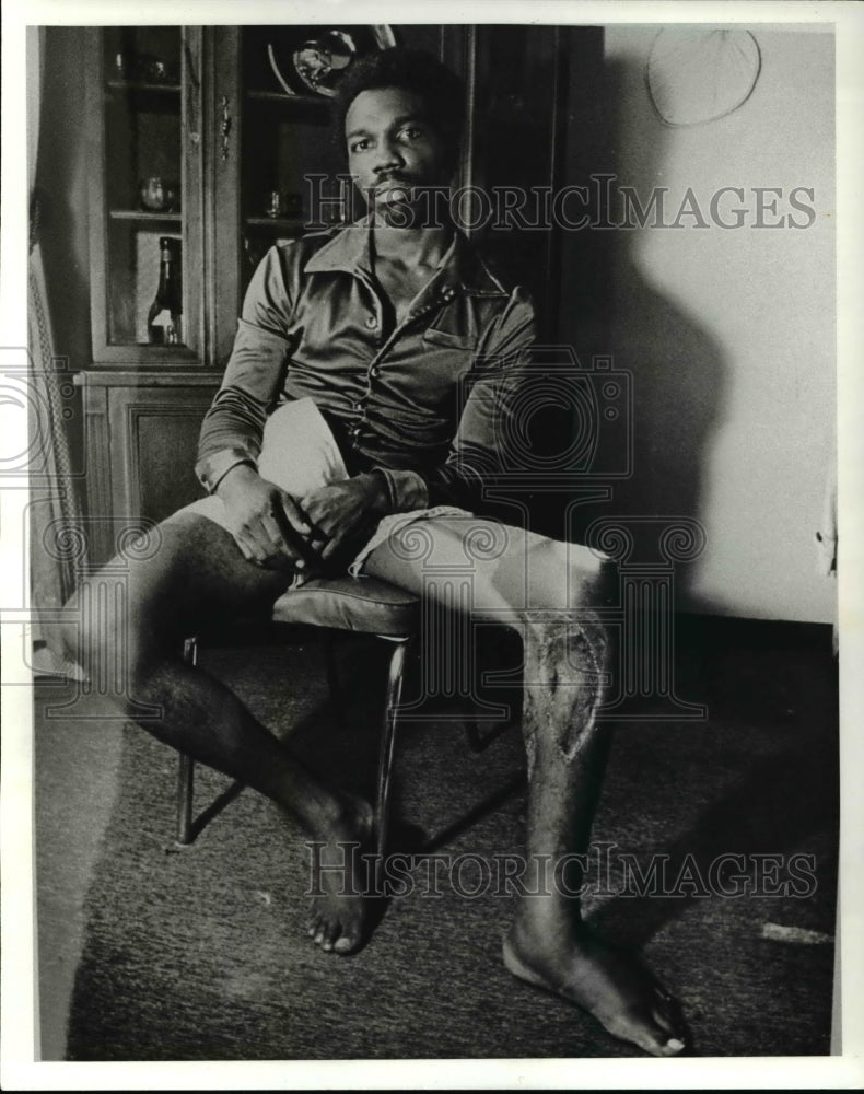 1982 Press Photo Michael T Todd at the home of Councilwoman Fannie Lewis - Historic Images