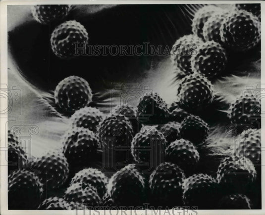 1974 Press Photo Ragweed Pollen magnified 1,250 times in electron microscope - Historic Images