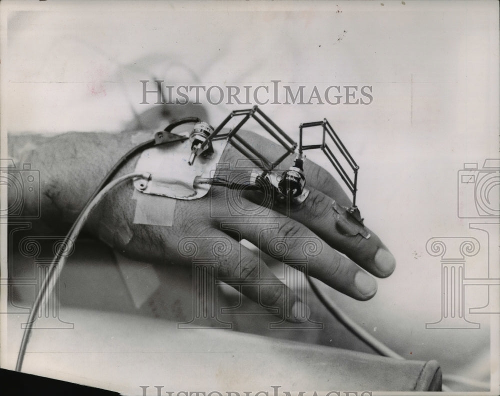 1963, Electrodes attached to Skin &amp; muscle to study impulses - Historic Images