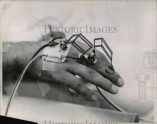 1963, Electrodes attached to Skin & muscle to study impulses - Historic Images