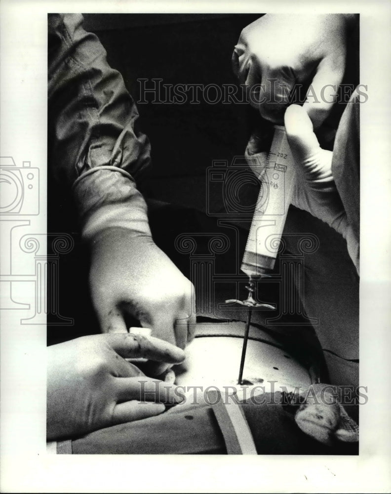 1984 Press Photo Medicine Surgery - Historic Images