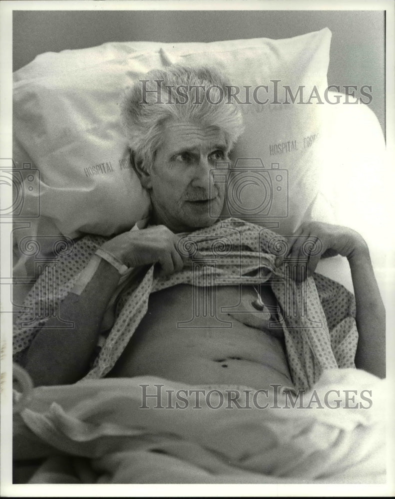 1984 Press Photo Michael Moran Shows the Implanted Defibrillator - cva67421 - Historic Images